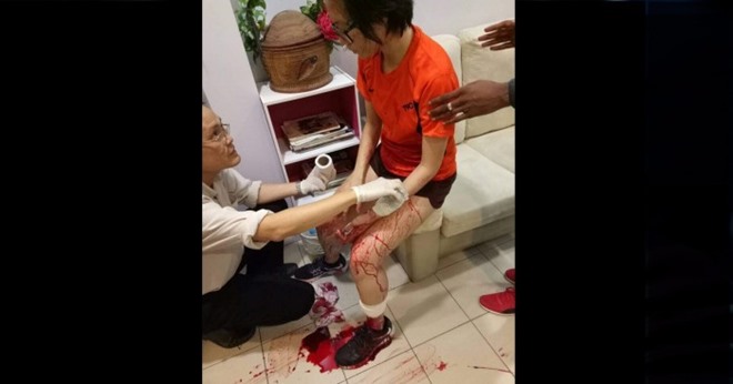 跑步时被外勞抢劫乱摸身体　华裔女子负伤逃跑求助 中国财经界 www.qbjrxs.com
