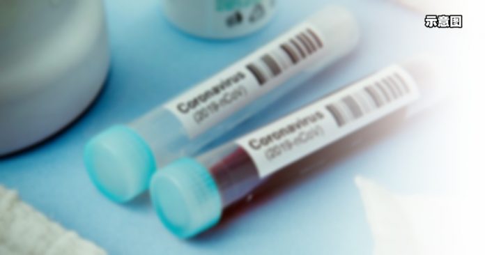is_200225_coronavirus_covid-19_test_800x450