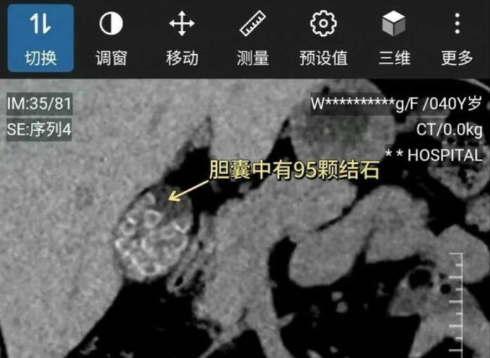 dd75bf6e1bb55c87da9802ec96a240e9